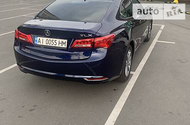 Седан Acura TLX 2017 в Киеве