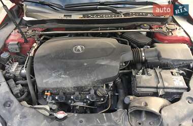 Седан Acura TLX 2016 в Києві