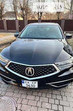 Седан Acura TLX 2018 в Черкассах