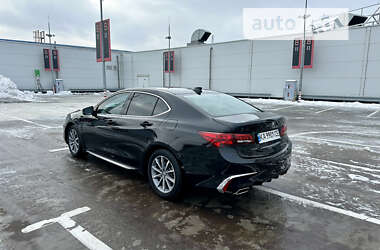 Седан Acura TLX 2017 в Киеве