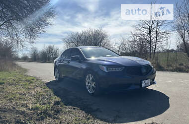 Седан Acura TLX 2017 в Хмельницком