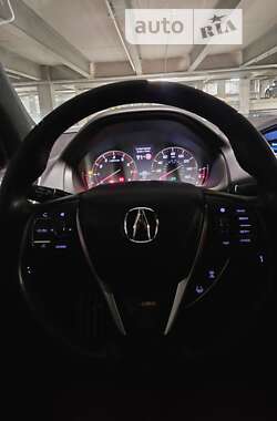 Седан Acura TLX 2017 в Виннице