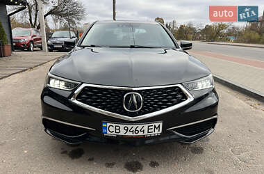 Седан Acura TLX 2017 в Чернігові