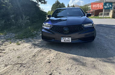 Седан Acura TLX 2017 в Хмельницькому