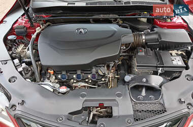 Седан Acura TLX 2016 в 