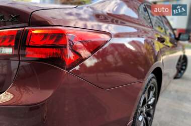 Седан Acura TLX 2014 в 