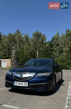 Седан Acura TLX 2015 в Чернігові