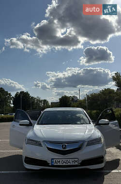 Седан Acura TLX 2016 в Житомире