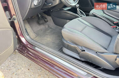 Хэтчбек Audi A1 2011 в 