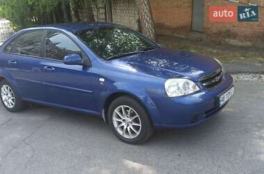 Седан Chevrolet Lacetti 2006 в Виннице