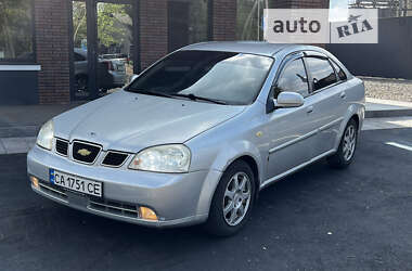 Седан Daewoo Lacetti 2003 в Золотоноші