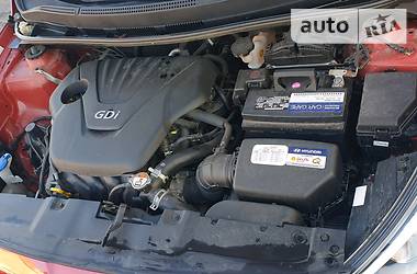 Хетчбек Hyundai Accent 2015 в 