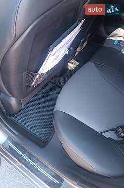 Хэтчбек Hyundai Accent 2014 в 