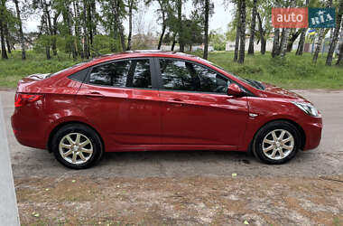 Седан Hyundai Accent 2013 в Ахтырке