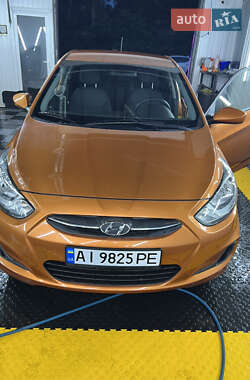 Хэтчбек Hyundai Accent 2016 в Киеве