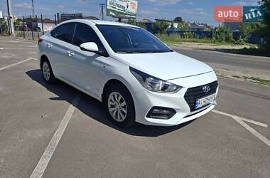 Седан Hyundai Accent 2018 в Киеве