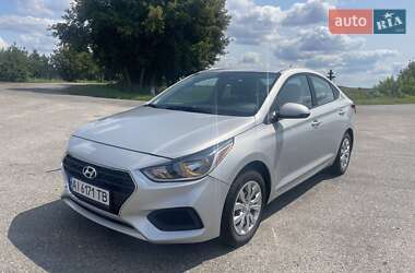 Седан Hyundai Accent 2021 в Житомирі