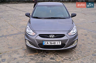 Хэтчбек Hyundai Accent 2017 в 