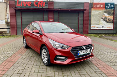 Седан Hyundai Accent 2017 в Черкассах