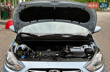 Седан Hyundai Accent 2011 в Житомире фото 29 Седан Hyundai Accent 2011 в Житомире
