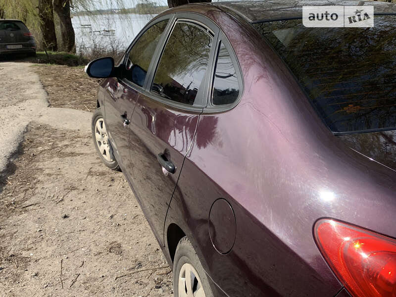 Седан Hyundai Elantra 2010 в Виннице фото 3 Седан Hyundai Elantra 2010 в Виннице