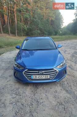 Седан Hyundai Elantra 2016 в Чернігові