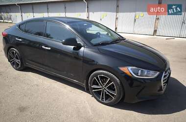 Седан Hyundai Elantra 2016 в Житомирі