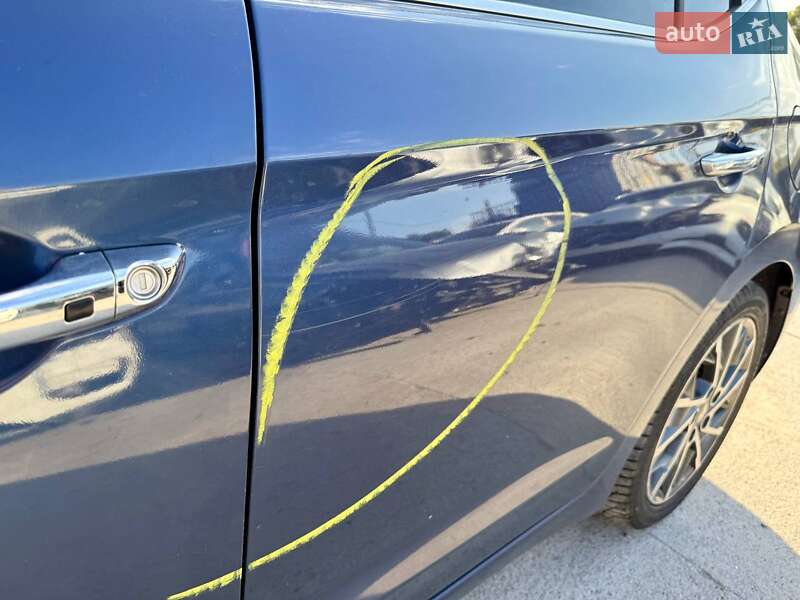 Седан Hyundai Elantra 2018 в Києві фото 8 Седан Hyundai Elantra 2018 в Києві