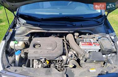 Хэтчбек Hyundai i20 2016 в 