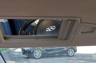 Хэтчбек Hyundai i30 2011 в Житомире