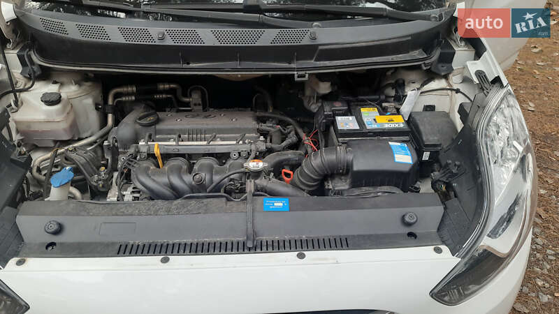 Хетчбек Hyundai ix20 2013 в Житомирі фото 38 Хетчбек Hyundai ix20 2013 в Житомирі