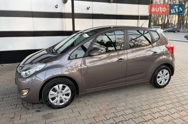 Хетчбек Hyundai ix20 2011 в Вінниці