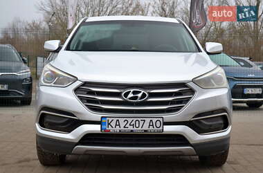 Внедорожник / Кроссовер Hyundai Santa FE 2016 в Бердичеве