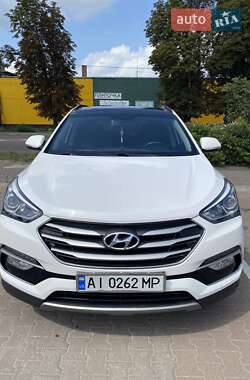 Внедорожник / Кроссовер Hyundai Santa FE 2016 в Житомире