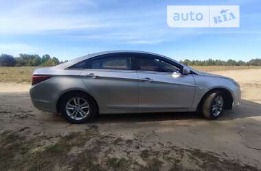 Седан Hyundai Sonata 2011 в Житомирі