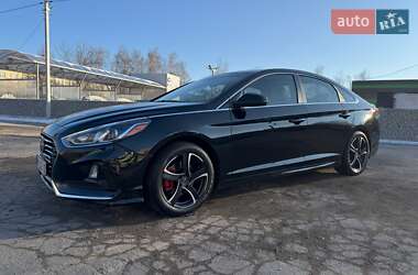 Седан Hyundai Sonata 2018 в Житомире