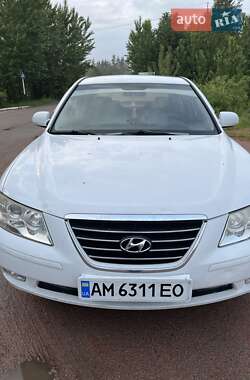 Седан Hyundai Sonata 2009 в Житомирі