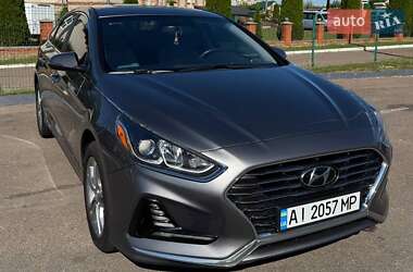 Седан Hyundai Sonata 2017 в Житомирі