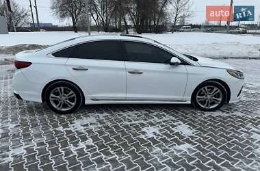 Седан Hyundai Sonata 2017 в Луцьку