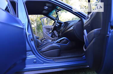 Хэтчбек Hyundai Veloster 2015 в 